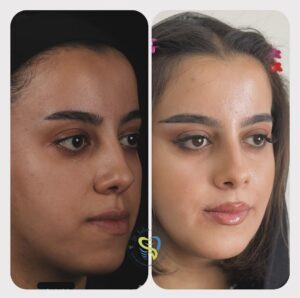 جراحي ارتوگناتيك (2)