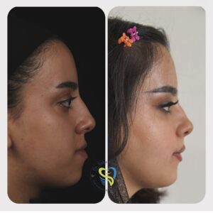 جراحي ارتوگناتيك