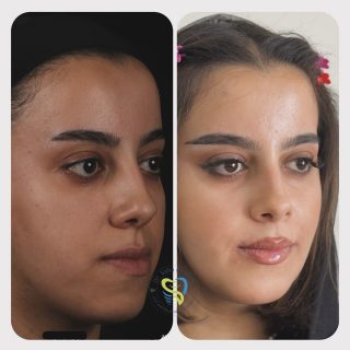جراحي ارتوگناتيك (2)