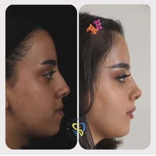 جراحي ارتوگناتيك