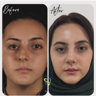 جراحي زيبايي بيني (2)