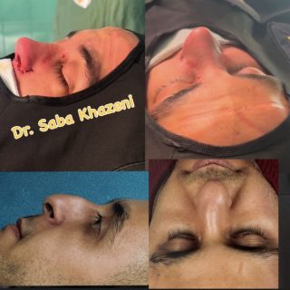 جراحي زيبايي بيني (3)